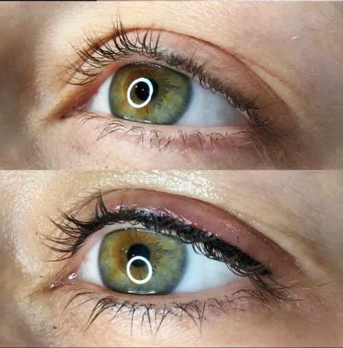 lash-enhancement-